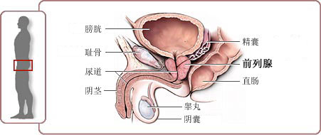 天津蓟州蓟州前列腺炎治疗方法